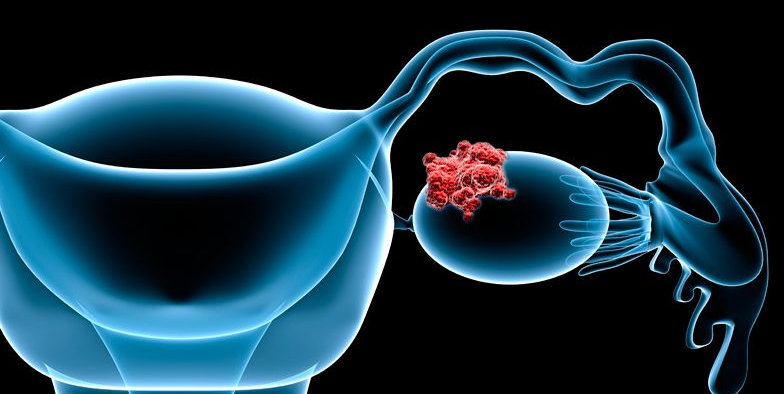 文献解读|Adv Sci（15.1）：KLF5 促进卵巢癌的肿瘤进展和 Parp