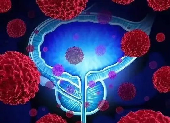 文献解读|Nat Commun（16.6）：不同阶段膀胱尿路上皮癌的蛋白质基因组