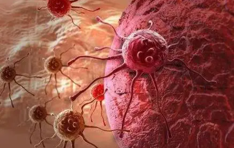 文献解读|Nat Cancer（22.7）：与肺癌 T 细胞浸润、炎症和免疫编辑