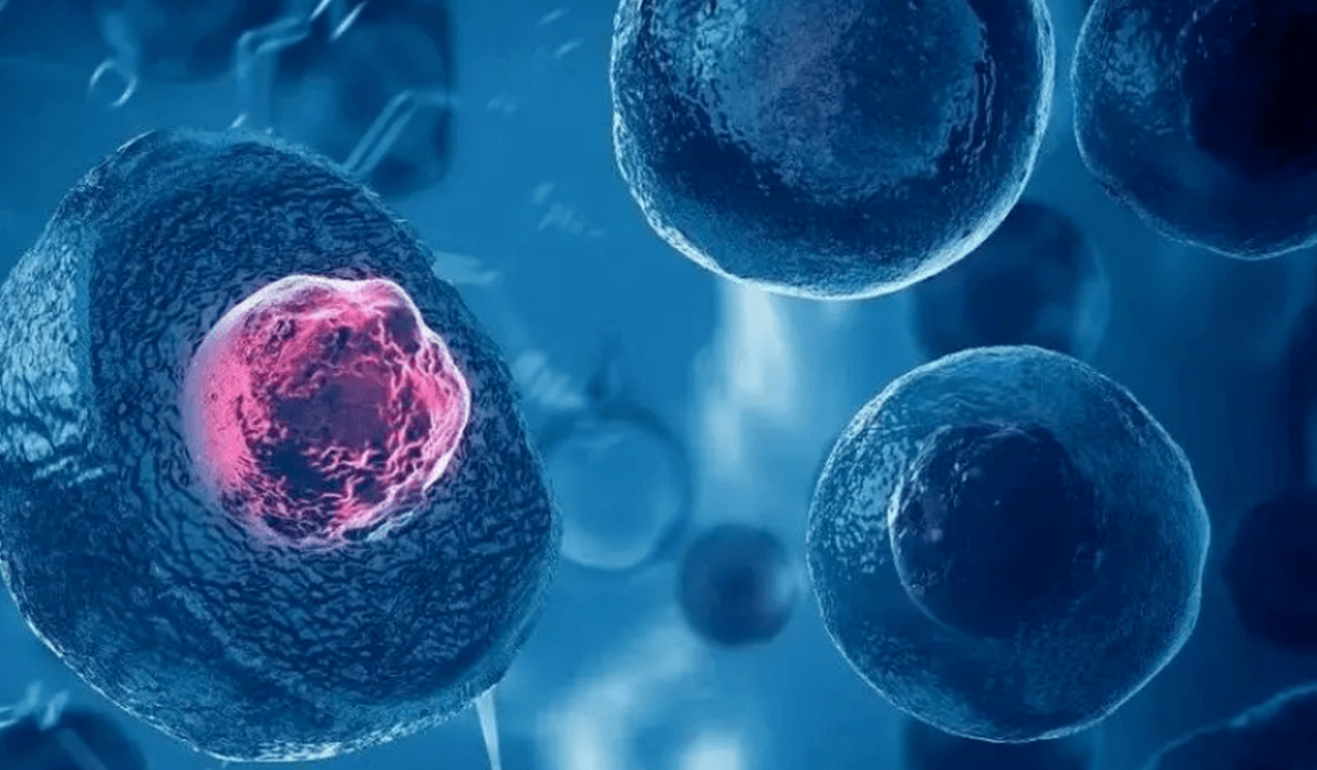 文献解读|Cancer Cell（50.4）：多发性骨髓瘤前体疾病的单细胞克隆型