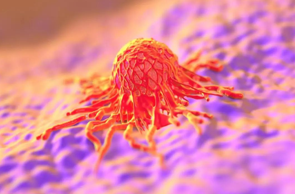 文献解读|Cancer Cell（50.3）：时间进化揭示侵袭小细胞神经内分泌前