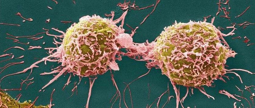 文献解读|Int J Mol Sci（6.208）：二轻杨梅素抑制宫颈癌细胞迁移