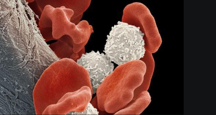 文献解读|Nat Genet（30.8）：BCR-ABL1淋巴细胞白血病的转录组