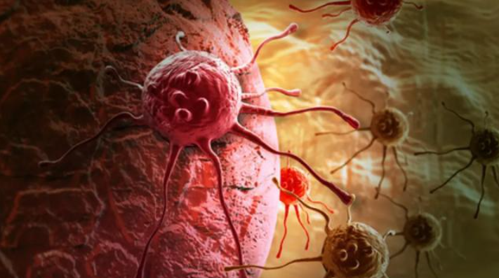 文献解读|Adv Sci（14.3）：乳腺导管癌的蛋白质组学图谱揭示肿瘤进展特征