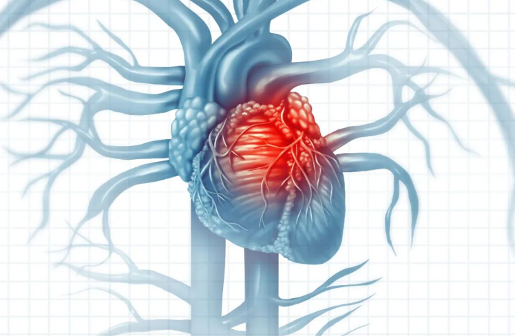 文献解读|Nat Commun（14.7）：感染性心内膜炎的血浆和赘生物蛋白质组
