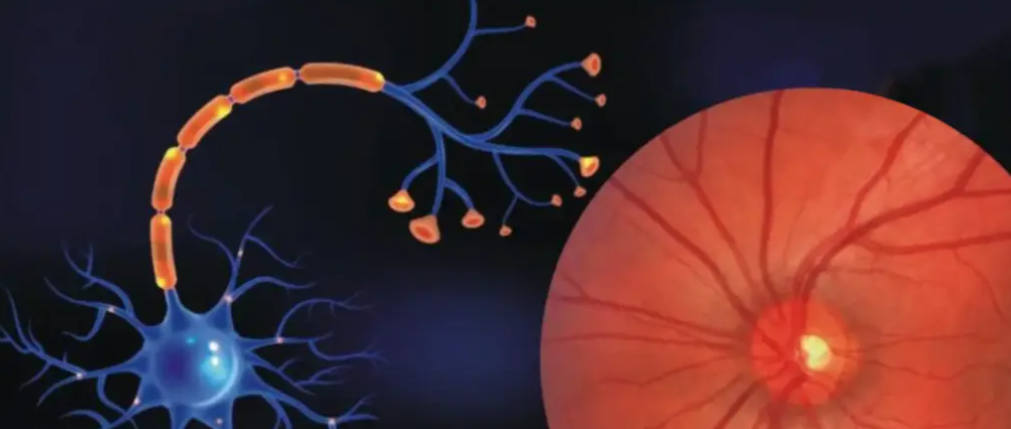 文献解读 |Signal Transduct Target Ther （ 52.